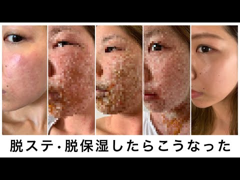 【閲覧注意】脱ステロイド・脱保湿、肌再生までの記録（アトピーじゃないです）