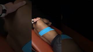Taping For Rib Pain
