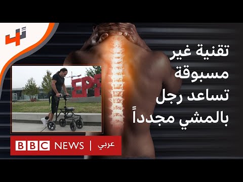لأول مرة رجل يمشي مجددا بعد إصابة في النخاع الشوكي