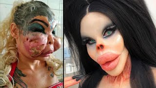 When Plastic Surgery Goes Horribly Wrong