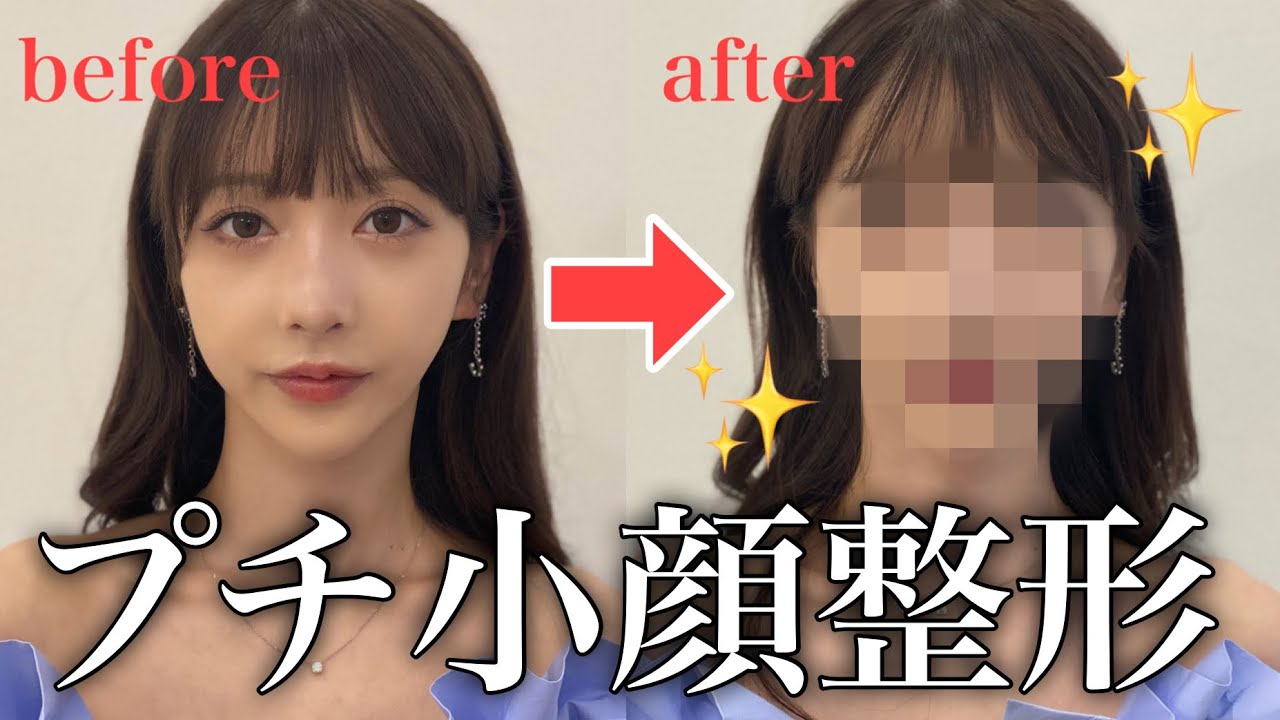 【休日密着】美容・整形のメンテナンスで可愛いをアップデートしてます💕