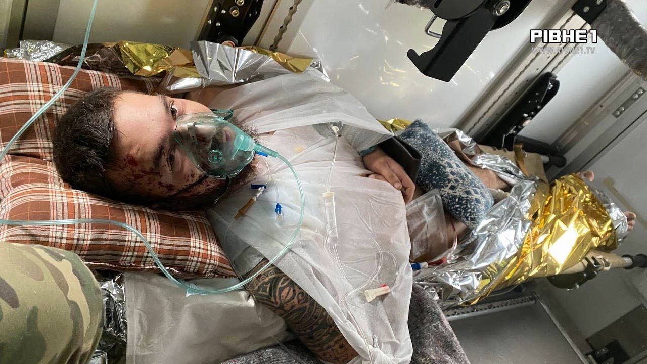 Нацгвардієць з Рівненщини показав себе важкопораненим аби продемонструвати ціну бажаної перемоги