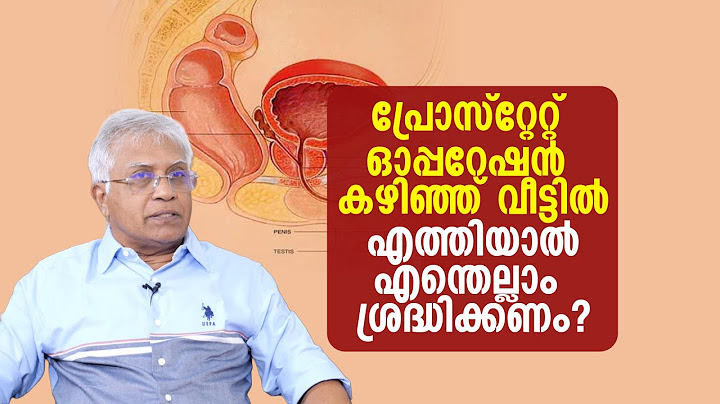 പ്രോസ്റ്റേറ്റ് ഓപ്പറേഷന് ശേഷം ശ്രദ്ധിക്കണം? | Prostate Surgery: What to Do When You Get Home! 🏡💙