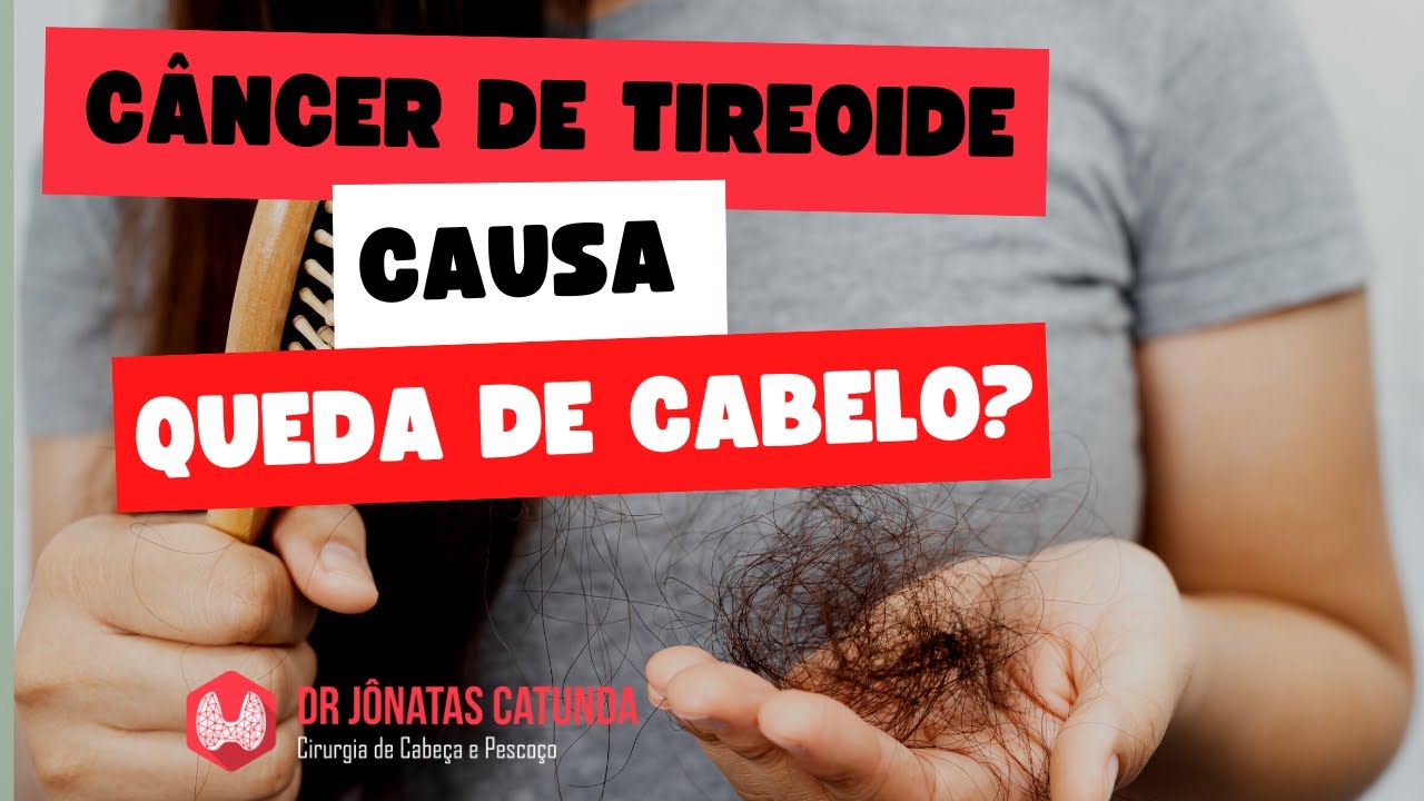 Câncer de tireoide causa queda de cabelo? - YouTube