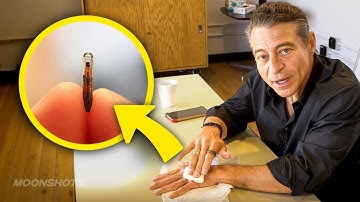 I Put a Microchip in My Hand. Here’s Why