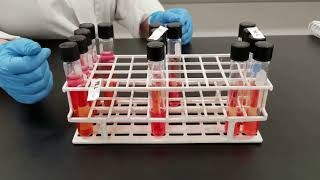 Microbiology of Water  Presumptive Test