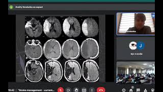 &quot;Stroke management - current state of affairs&quot;