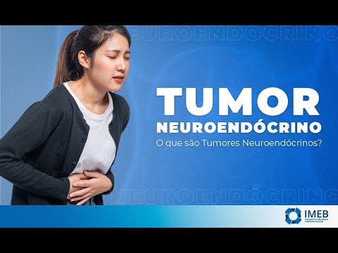 Vídeo: Quão comuns são os tumores carcinoides?