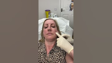 Circuit Skin Aesthetics