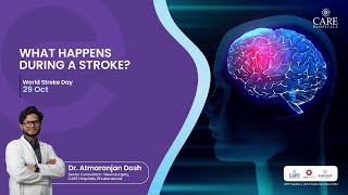 What Happens During a Stroke? | Dr. Atmaranjan Dash | CARE Hospitals, Bhubaneswar