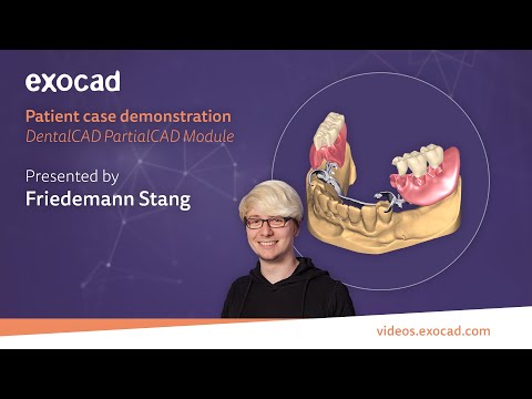 Patient Case Demonstration(3/6): DentalCAD PartialCAD Module