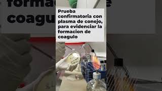 Frotis de manipuladores de alimentos en agar Baird Parker #laboratorio #BairdParker #manipuladores