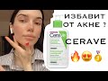 ИЗБАВИТ ОТ ПРЫЩЕЙ ЗА ДЕНЬ ? 😱CERAVE НАШУМЕВШАЯ УМЫВАЛКА