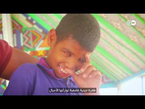 قرية موريتانية تعيش في عتمة وراثية وتواجه تحديات الحياة