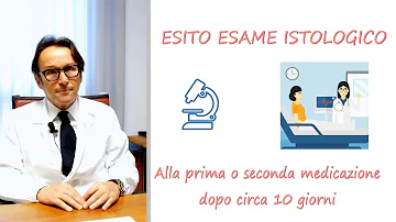 Quando si comincia la radioterapia dopo quadrantectomia?
