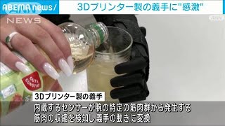 3Dプリンター製の義手に感激　ドイツの女性「シュニッツェルを切ることができる」(2023年8月25日)