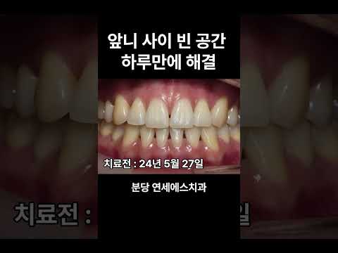 블랙트라이앵글 하루만에 감쪽같이 해결