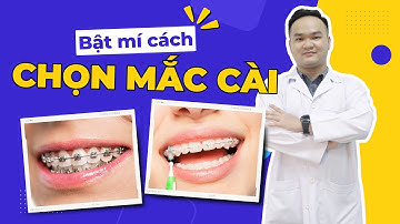 [BẬT MÍ] cách chọn mắc cài - Ưu và nhược điểm của từng loại I Nha Khoa Smile HT