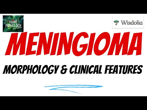 Meningioma | Part 2 | Histopathology | Clinical Features| Treatment& Prognosis