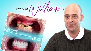 The Story of William: From no teeth to a Hollywood Smile! - Nano Dental