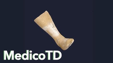 MedicoTD - 3D Scanner Demo