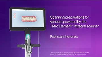 How to review veneer scans with the iTero Element™ Plus scanner | post-scanning workflow