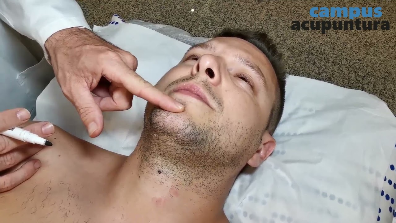 Punto x punto: Meridiano Maravilloso REN MAI - Prof. Raúl Ucieza | Campus Acupuntura