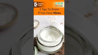 URTICARIA | HIVES - 5 IMPORTANT Tips to Know | Skin Allergy -Dr.Rasya Dixit| Doctors