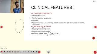 Hepatic encephalopathy