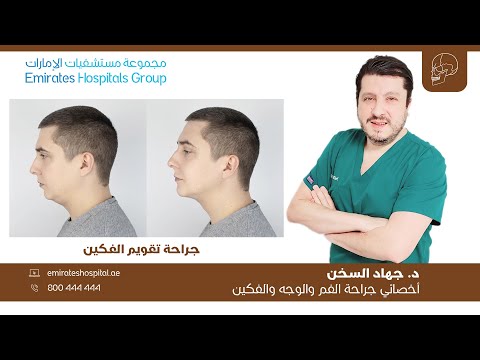 جراحة تقويم الفكين البروفيسور د جهاد السخن اخصائي جراحة الوجه والفكين الرأس والرقبة