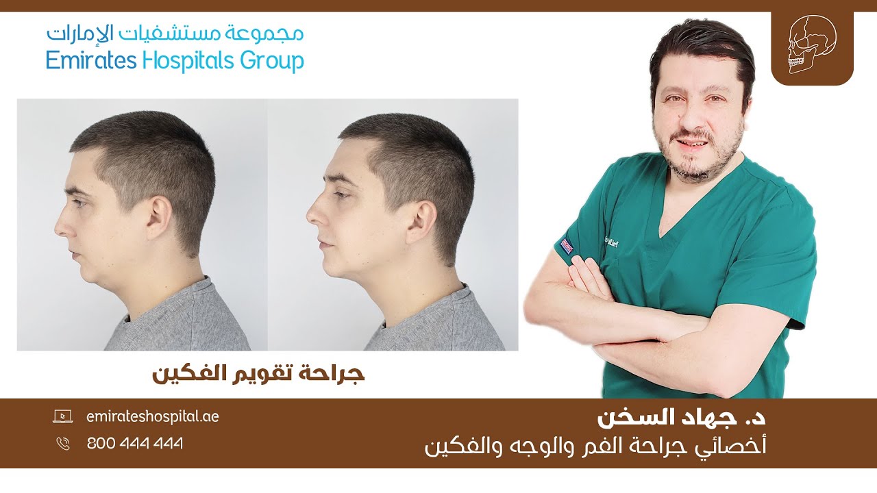 جراحة تقويم الفكين | البروفيسور د. جهاد السخن اخصائي جراحة الوجه والفكين، الرأس والرقبة