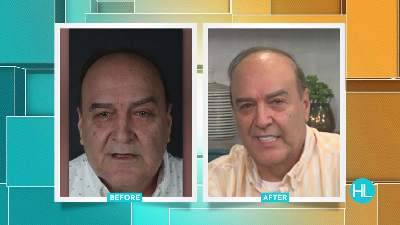 No more dentures! See how dental implants can help restore a patient’s teeth and smile