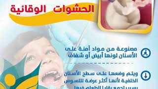 الحشوات الوقائية للأطفال لحماية اسنان الاطفال من التسوس بافضل العروض والاسعار في عيادات نيويو