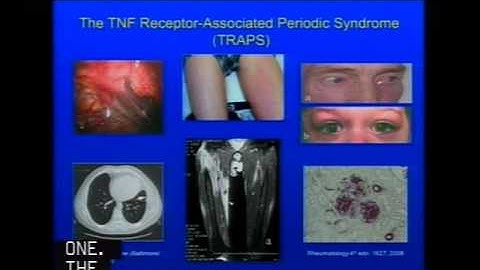 Fevers, Genes, and Histories: Adventures in the Genomics of Inflammation