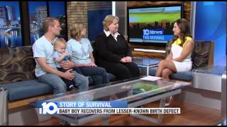 Famous Rare Birth Defects Profile