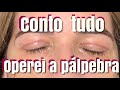 Como foi minha cirurgia de pálpebra