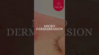 Microdermabrasion