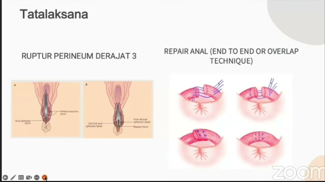 Kegawatdaruratan Obstetri