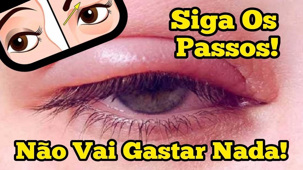Pálpebras Inchadas Como Tratar? Exercícios Caseiros Para Desinchar As ...