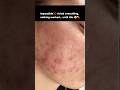 Impossible Skin Transformation 😳💊 | Free PDF Skin Guide!