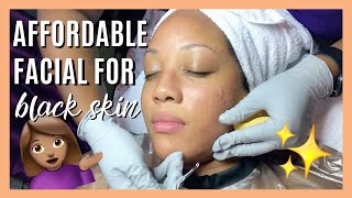 $75 ACNE CLEARING FACIAL | EXTRACTIONS & DEEP PORE CLEANSING