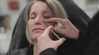 Beautiphi Clinic - Bunny lines treatment witth Botox