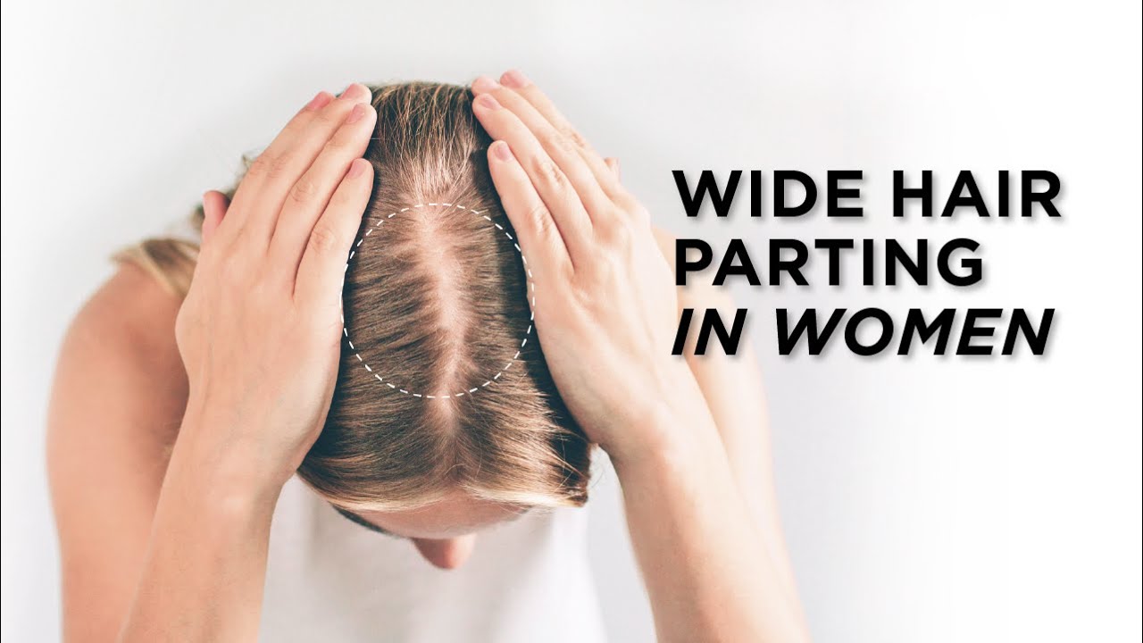 Why is my hair part so wide? (Answered) - ShutterBulky