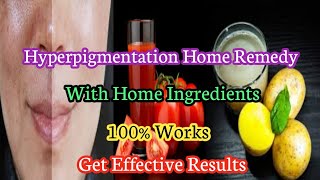 Hyperpigmentation, Darkspots Home Remedy | ? Works | Get Effective Results |With Home Ingredients ✨?