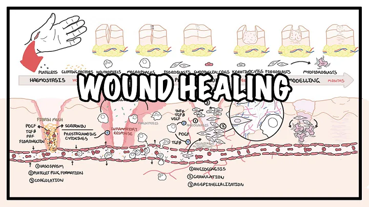 Wound Healing - Stages of healing and pathology