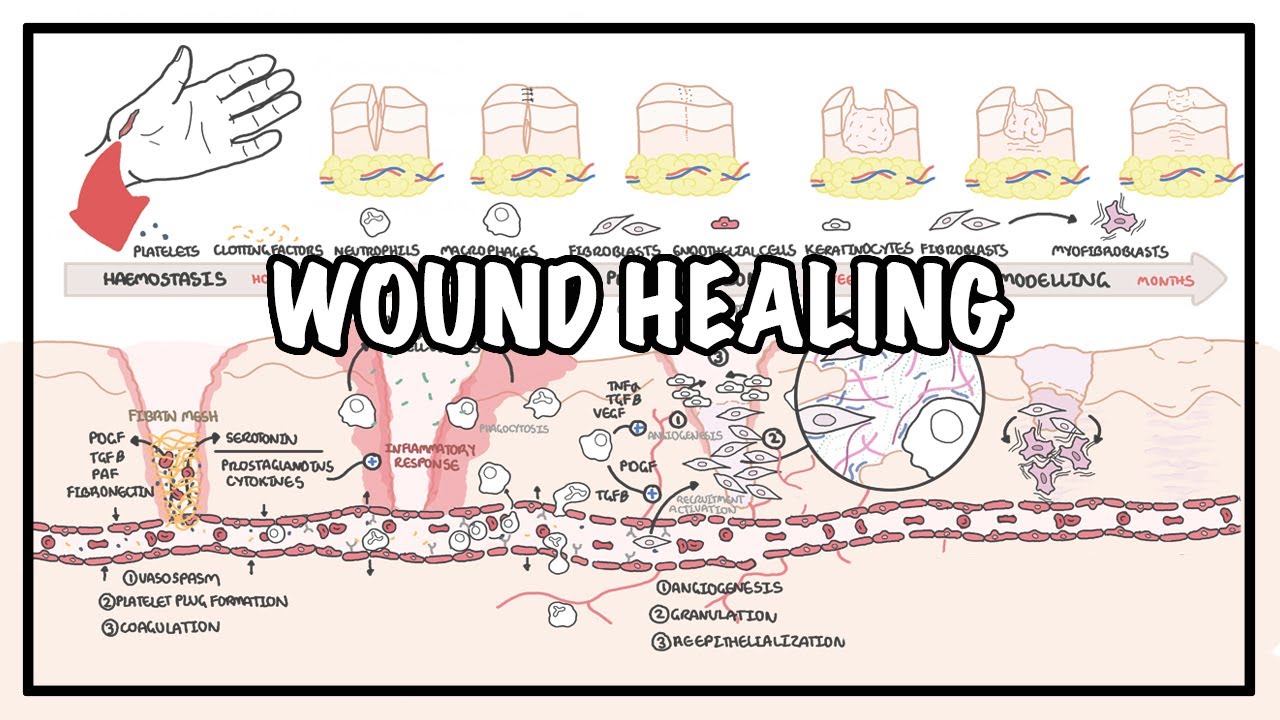 Animation of gunshot wound