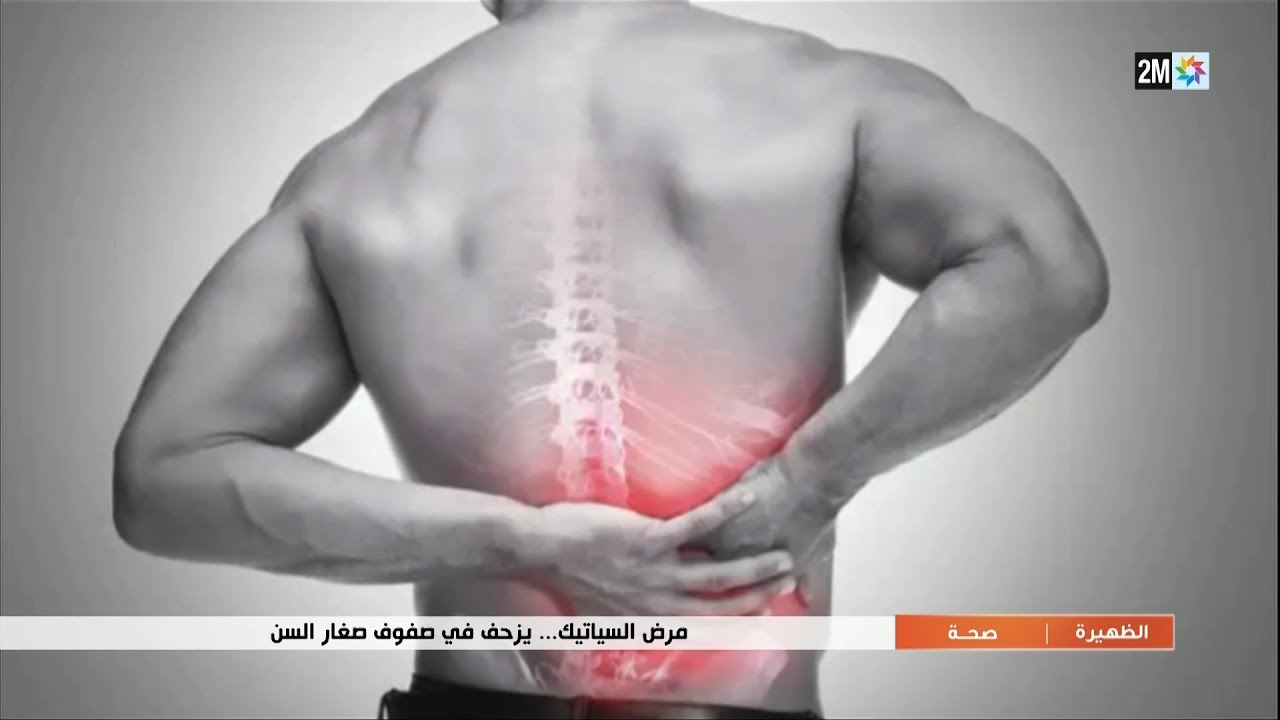 مرض السياتيك... يزحف في صفوف صغار السن...التفاصيل في الربورتاج
