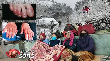 Cẩn thận trời lạnh: Đột quỵ, nhồi máu cơ tim bất ngờ và cách phòng ngừa hiệu quả | Kỹ năng sống