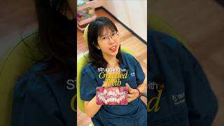 Not Just Ugly Teeth - Crowded Teeth Are Breeding Ground for Cavities | Dr Tooth Dental MY