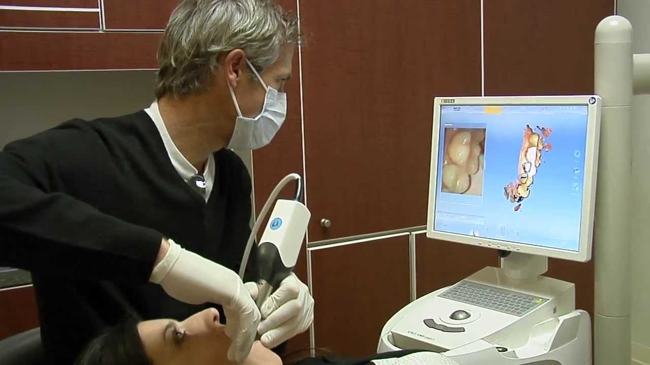 cerec accept cerec accept